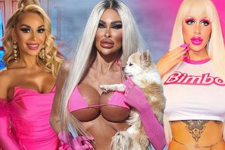 5 žen posedlých Barbie vzhledem, které nic nezastaví: Infekce, dětský olej jako výplň ani hnijící maso je neodradily - Super.cz