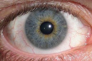 Tuto nemoc odhalíte pohledem na bílou zeď: Vypadá jako oční červy