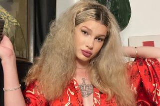 Influencerka si plastikami zničila obličej. Ženáči jí teď ale platí tisíce, jen aby s nimi promluvila - Super.cz