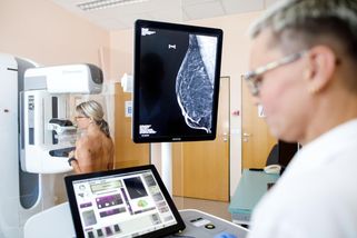 Tiše rostl. Nádor našli lékaři u desítek tisíc lidí díky screeningu včas - Novinky