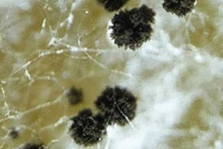 Zákeřná infekce napadá v Česku i úplně zdravé lidi. Léčí se dlouho, draze a bude hůř