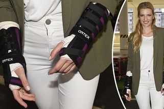 Na módní show dorazila s ortézou na obou rukou: Kráska Veronika Chmelířová si přivodila nepříjemné zranění - Super.cz