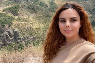 Tři zpackané plastiky nosu ji připravily o možnost dýchat i sebevědomí: Bolest je nesnesitelná, zoufá si žena