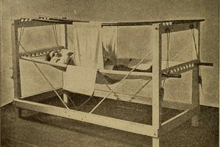 Symfyziotomie: Zákrok, který ubližoval. Irsko ho provádělo i po nástupu císařského řezu