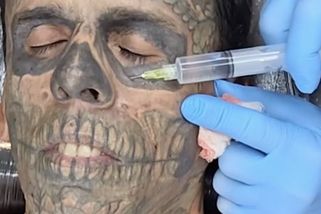 Brazilec si nechal odstranit z obličeje tetování. Výsledek je pozoruhodný - Novinky