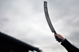 Bránil svou přítelkyni, schytal to mačetou - Novinky