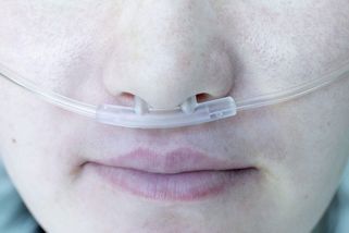 Trpí těžkou chorobou plic a je uvězněna v domě. Chybí jí peníze na přenosný kyslíkový koncentrátor - Novinky