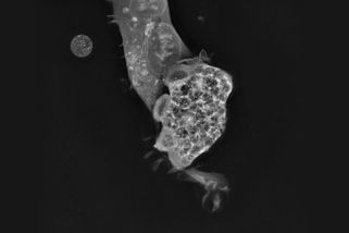 Parazit požírající mozek zabil další dítě. Po koupání v americkém jezeře - Novinky