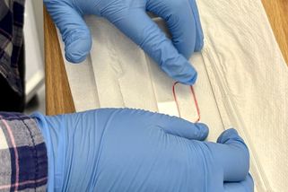 Částečná kloubní náhrada místo totální endoprotézy. Revoluční řešení vyvíjejí čeští odborníci - Novinky