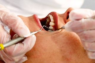 Křivé zuby má většina Čechů. Ne každý si však může dovolit rovnátka - Novinky