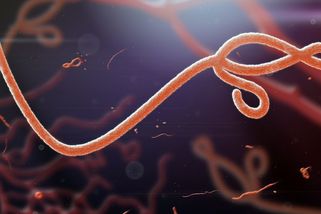 Ebola v Česku? Tohle není začátek epidemie, uklidňuje lékař - Seznam Zprávy
