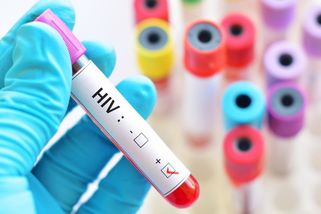 V Česku se nedaří zkrotit nákazu HIV, počty případů trhají rekordy - Novinky