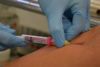 Žloutenka se přesouvá z Prahy a středních Čech na Moravu, kde zemřel 41letý muž - Novinky