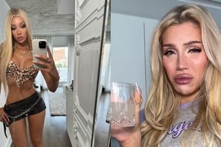 Influencerka znechutila internet: Z vlastních odoperovaných žeber si uvařila vývar