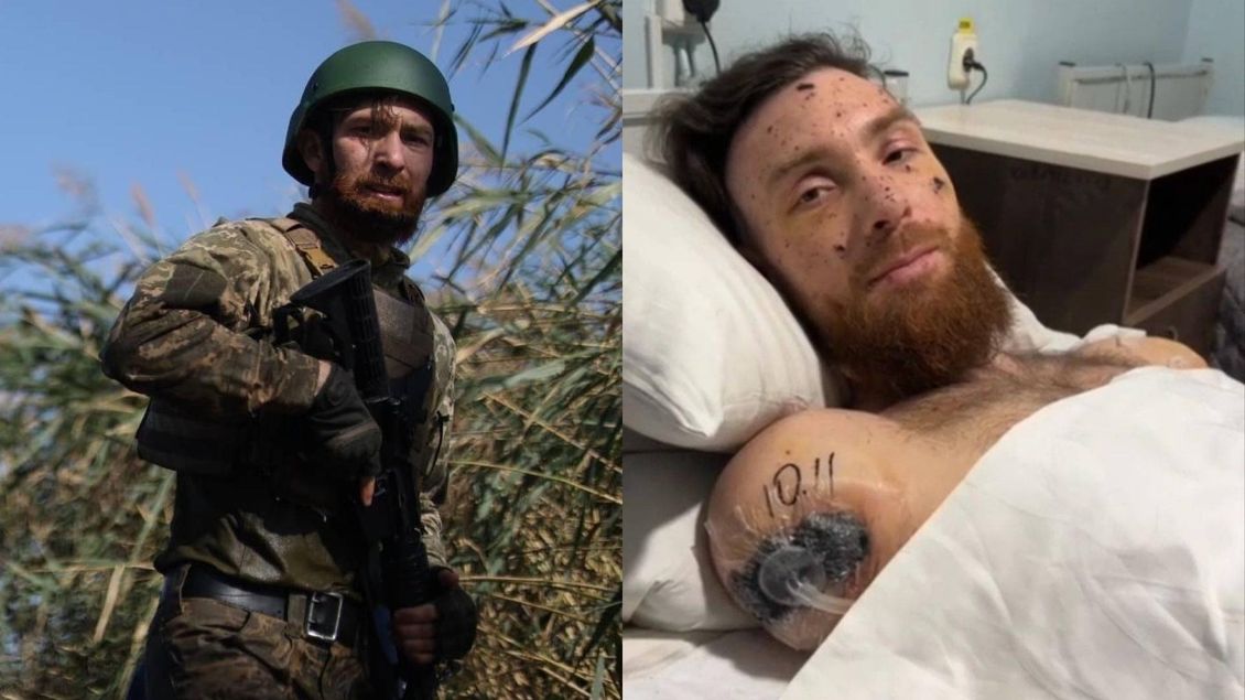 Ruce pro Artema - Dárek pro Putina