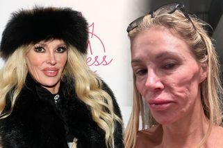 Deformace, otoky a pohyby pod kůží: Televizní hvězda našla příčinu svých parazitů