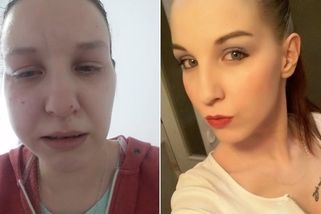 Zubař hrůzy se vyjádřil k teplickým pacientům: Jejich jednání je neprofesionální a chaotické – eXtra.cz