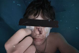 „Přetáhl mě sklenicí po obličeji.“ Koncert skončil útokem na teenagera - Seznam Zprávy