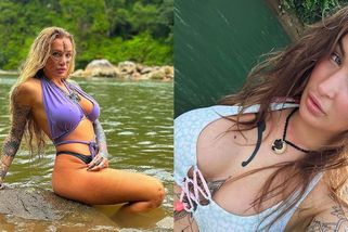 Bývalé hvězdě filmů pro dospělé praskly silikony: Prsa teď budou vypadat nechutně, bojím se i o zuby, řekla Daisy Lee - Super.cz