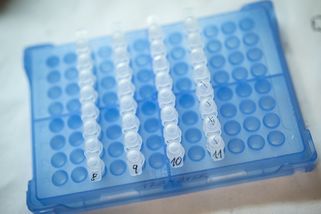 Variantu omikron v Česku potvrdil i přesnější test - Seznam Zprávy