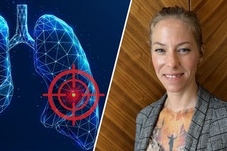 Lucie: Rakovina plic mě naučila vážit si přítomnosti