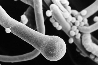 Oteplování může podpořit šíření houby, která je schopná nás „sežrat zevnitř“, varují vědci - Novinky