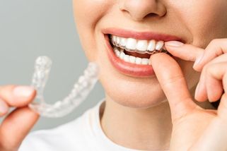 „Radši jsem si koupila auto.“ Rovnátka vyjdou i na sto tisíc - Seznam Zprávy