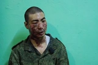 Rusové zajali českého občana bojujícího na Ukrajině. Má vážná zranění - Seznam Zprávy