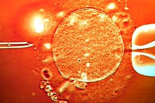 Dárce spermatu přenášel vzácnou genovou mutaci, téměř 200 dětem hrozí rakovina - Seznam Zprávy