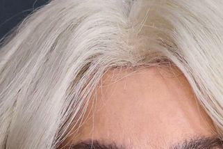 Je jí 78 let a chodí se zajíčkem. Zpěvačka je královnou plastik a její vzhled nechápe polovina světa | Kdo to je?