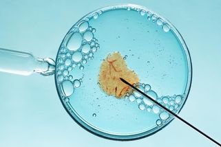 „Něco je špatně.“ Kliniky asistované reprodukce spletly rodinám dárce - Seznam Zprávy