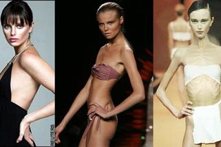 Proměnila se v chodící kostru. Neřešili to. Mladinkou modelku zabil nezájem okolí | Geniální, ale...