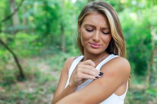 Co platí na štípance od hmyzu? Tyhle babské rady fungují a nemusíte ani do lékárny! - Proženy.cz