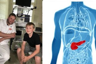 Docent z MOÚ Jan Trna: Rakovině slinivky břišní můžete předejít. Nepodceňte tyto varovné příznaky | Na slovíčko s Tomášem