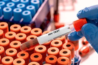 Nových případů HIV bylo loni nejvíc od roku 1985 - Novinky