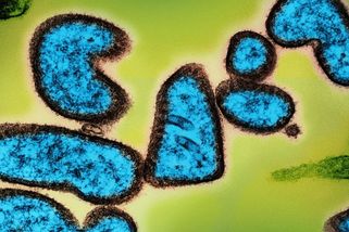 Česko varuje před silně smrtícím virem. Lék dosud neexistuje, příznaky začínají nenápadně