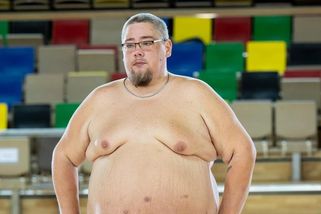 Honza z Extrémních proměn ukázal tělo po operaci. Klinika zveřejnila výsledek zákroku