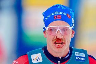 Lyžařský horor si vyžádal krev. Myslel jsem, že umřu, přiznává Nor - Sport.cz