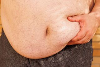 Obezitu mají dva miliony Čechů. Někteří by mohli dostat léky na pojišťovnu - Seznam Zprávy