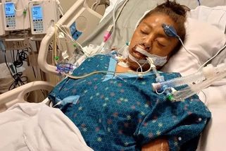 Pitbul v USA srazil cyklistku. Pokousal ji tak, že jí museli amputovat obě ruce i nohy - Novinky