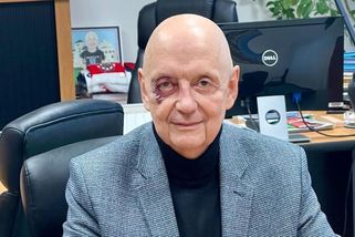 Blanenský starosta zveřejnil fotku s monoklem. S nikým jsem se neporval, ale fakt to klouže, varuje - Novinky