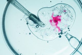 Globální krize neplodnosti. Roboti by ji mohli pomoci vyřešit - Seznam Zprávy