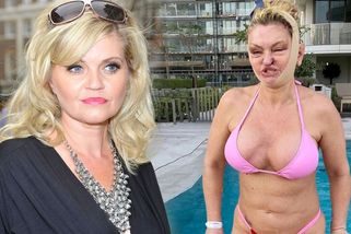 Danniella Westbrook po dalším zákroku: Děsí obličejem i zpackanou plastikou ňader!