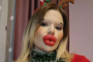 Žena s největšími rty světa se předvedla ve vánočním: A sob Rudolf bledne závistí! - Super.cz