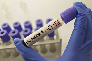 Epidemie žloutenky slábne. Nejvíce zasaženým regionem je jižní Morava - Seznam Zprávy