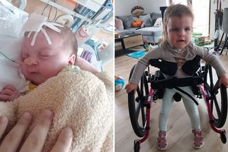 Teprve 53. na světě. Čtyřletá Diana se narodila s unikátní kombinací anomálií a potřebuje pomoc