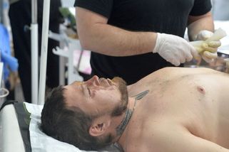 Ukrajinské superodolné bakterie jako varování. „Tichá pandemie“ bobtná i u nás - Seznam Zprávy