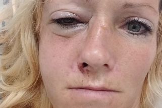 Stále se bojíme. Snažíme se být ve skupině, říkají Ukrajinky, které napadli - Seznam Zprávy