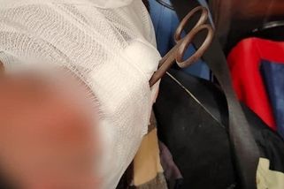 Žena zabodla partnerovi do hlavy nůžky - Novinky