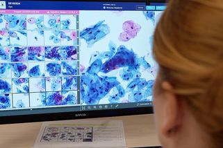 „Doktor“, který se nikdy neunaví. V plzeňské laboratoři hledá nádory - Seznam Zprávy